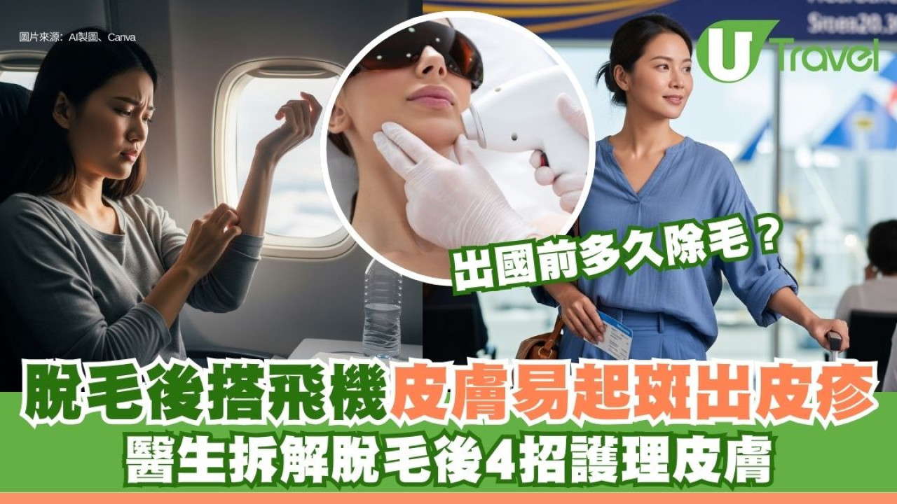 脫毛後搭飛機皮膚易起斑出皮疹 醫生拆解脫毛後4招護理皮膚