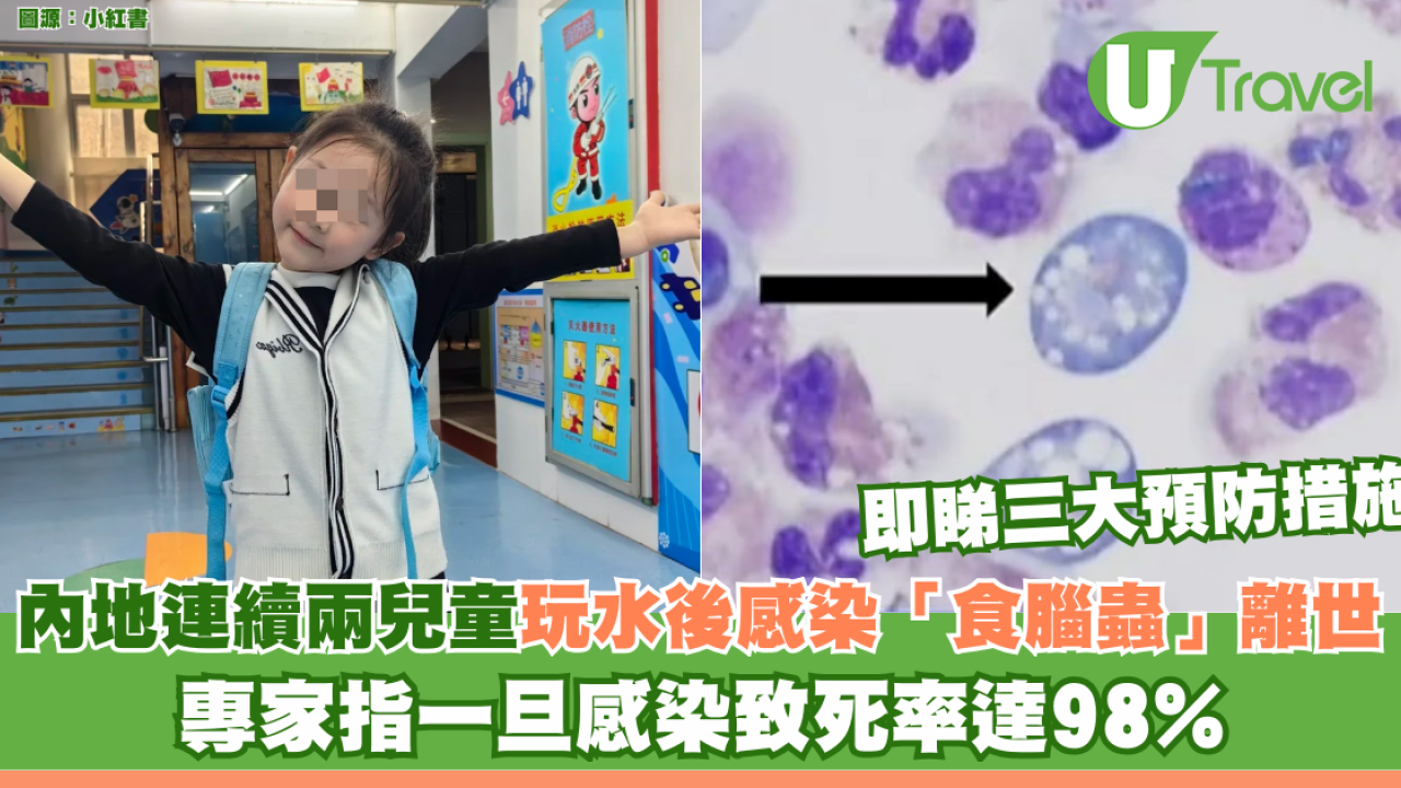 內地連續兩名兒童玩水後感染「食腦蟲」死亡！專家指一旦感染致死率達98%