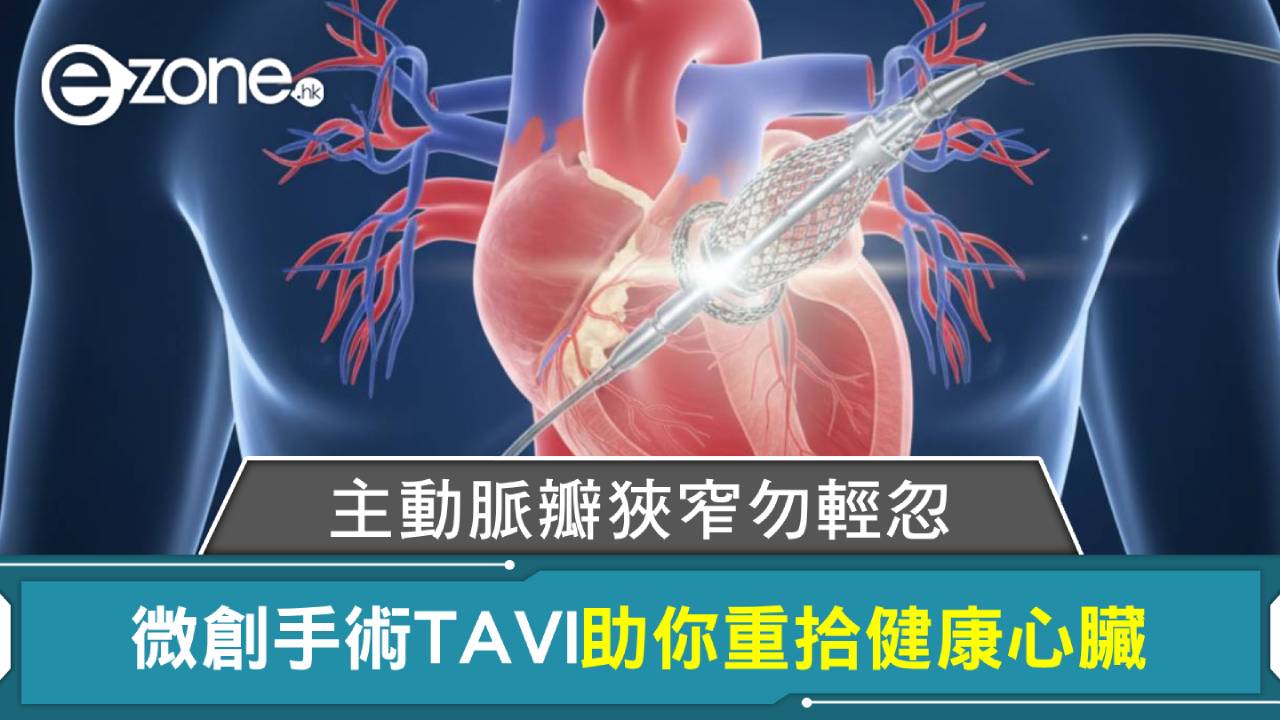 主動脈瓣狹窄勿輕忽：微創手術TAVI助你重拾健康心臟