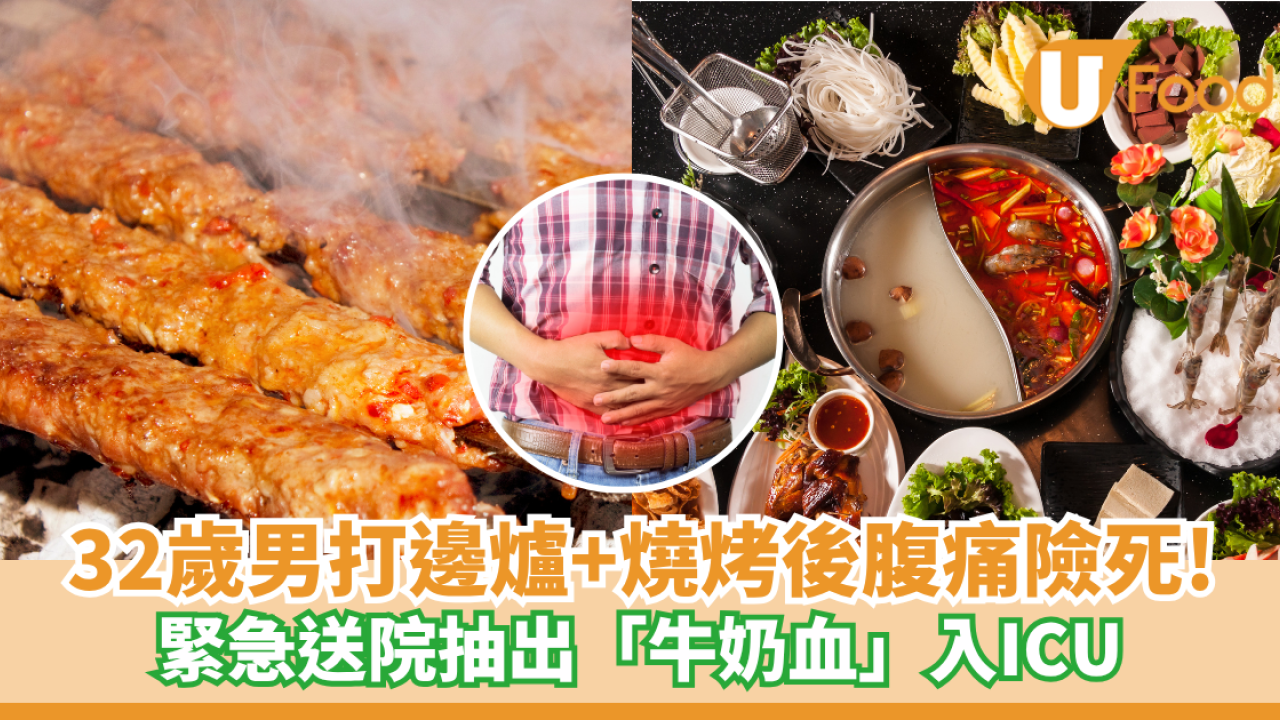 32歲男打邊爐+燒烤後腹痛險死！緊急送院抽出「牛奶血」入ICU搶救