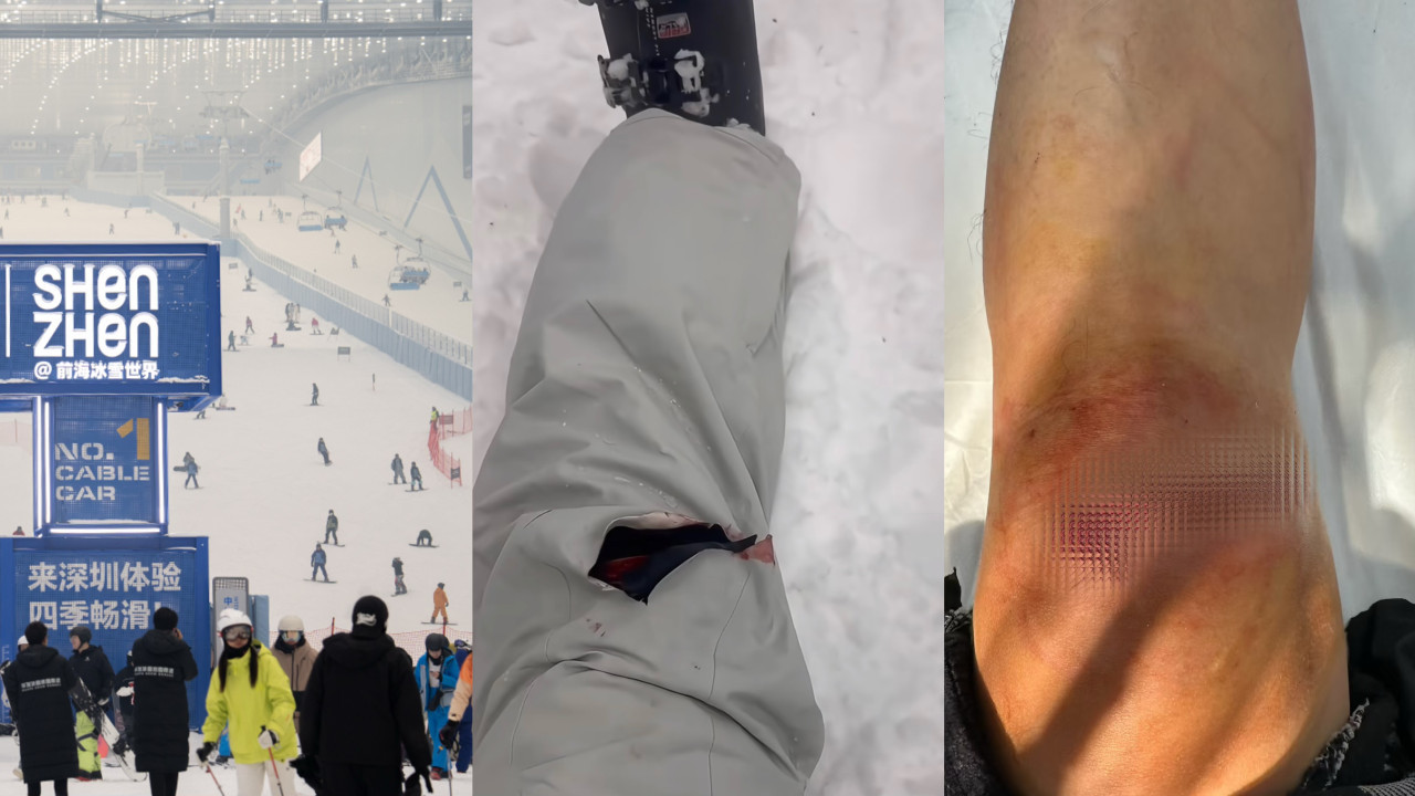 華發冰雪世界「見底」！港客滑雪重摔縫12針 怒轟：水泥地板肉眼可見