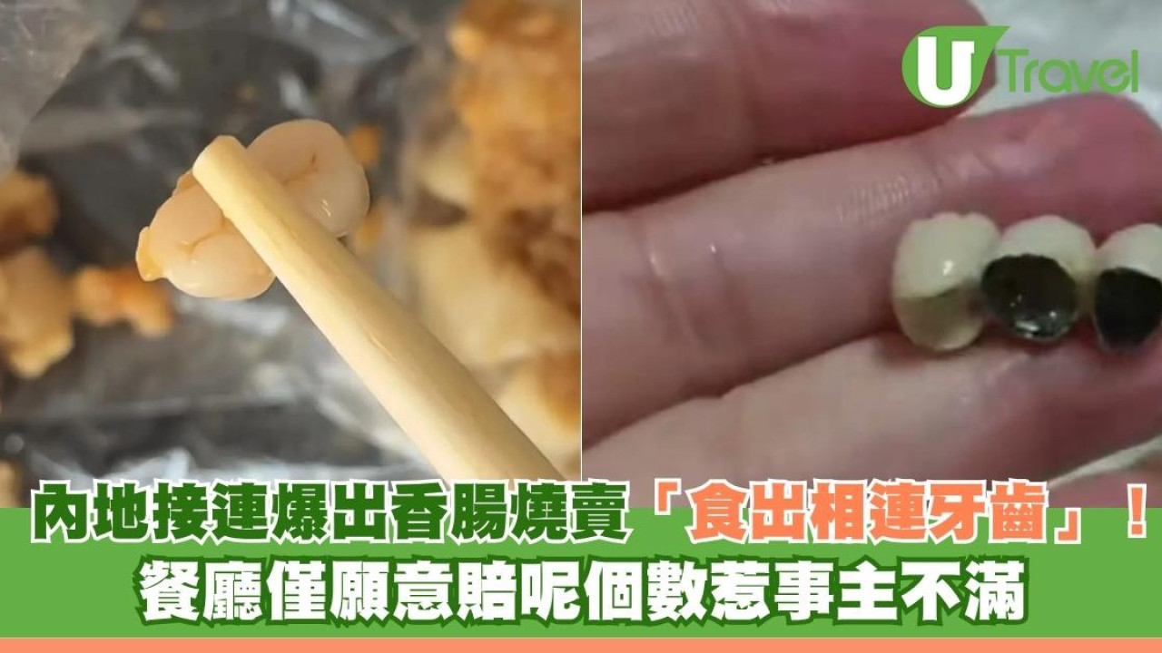 內地接連爆出香腸燒賣「食出相連牙齒」！ 餐廳僅願意賠呢個數惹事主不滿