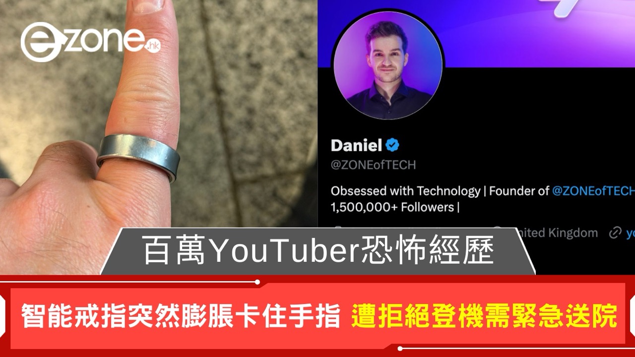 百萬YouTuber恐怖經歷 智能戒指膨脹卡住手指無法脫下 遭拒絕登機需緊急送院