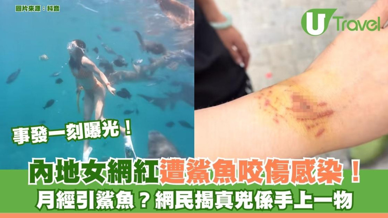 事發一刻曝光！內地女網紅遭鯊魚咬傷感染！ 月經引鯊魚？網民揭真兇係手上一物