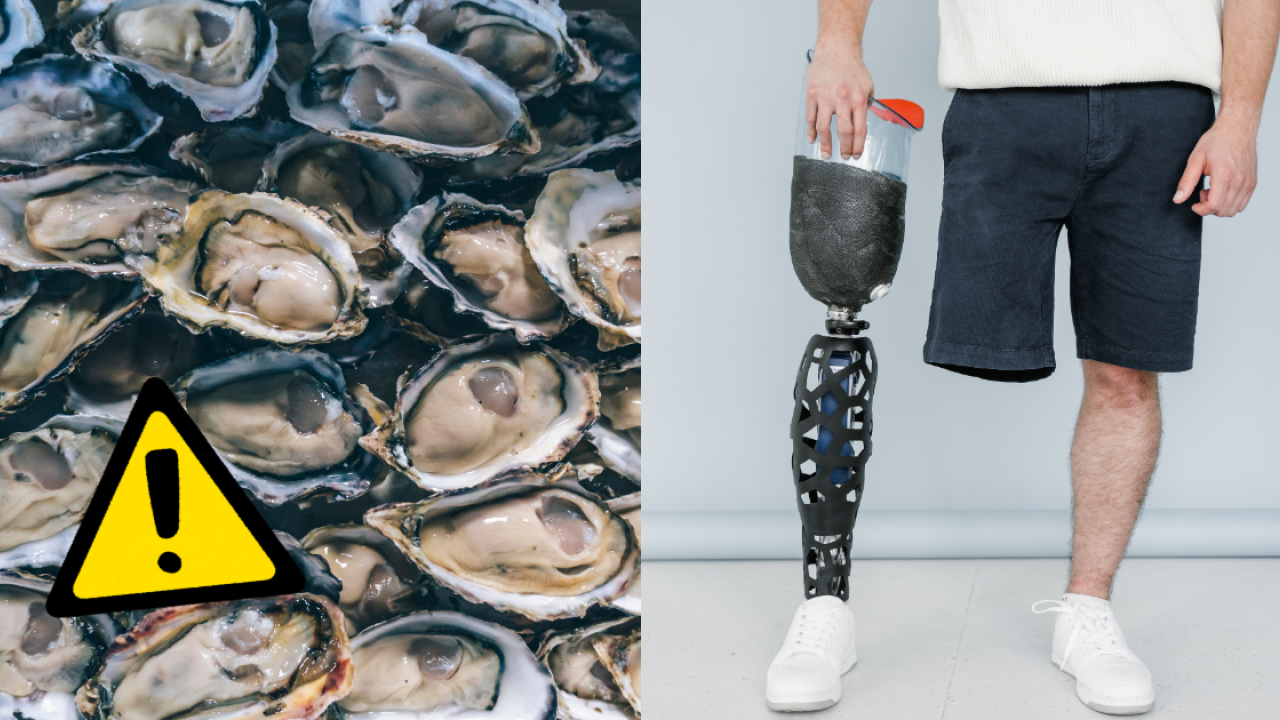 食一次即截肢!? 54歲壯男歎生蠔染食肉菌7日亡／衛生署：3類海鮮極高危 死亡率達3成