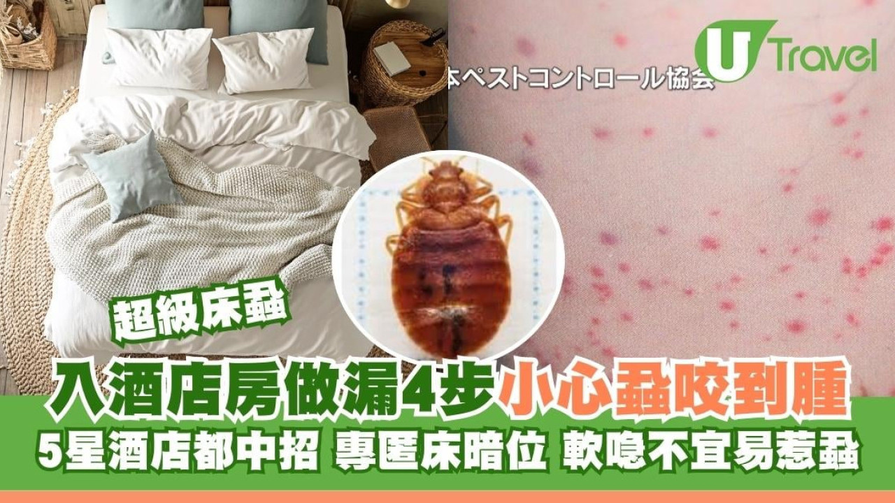 床蝨易入屋小心這款喼！日本5星酒店都中招！入房黃金5分鐘做齊4步防蝨