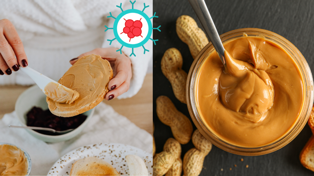 女子日食花生醬致肝癌末期！醫生揭致癌元兇／消委會：6成花生醬樣本含黃麴毒素