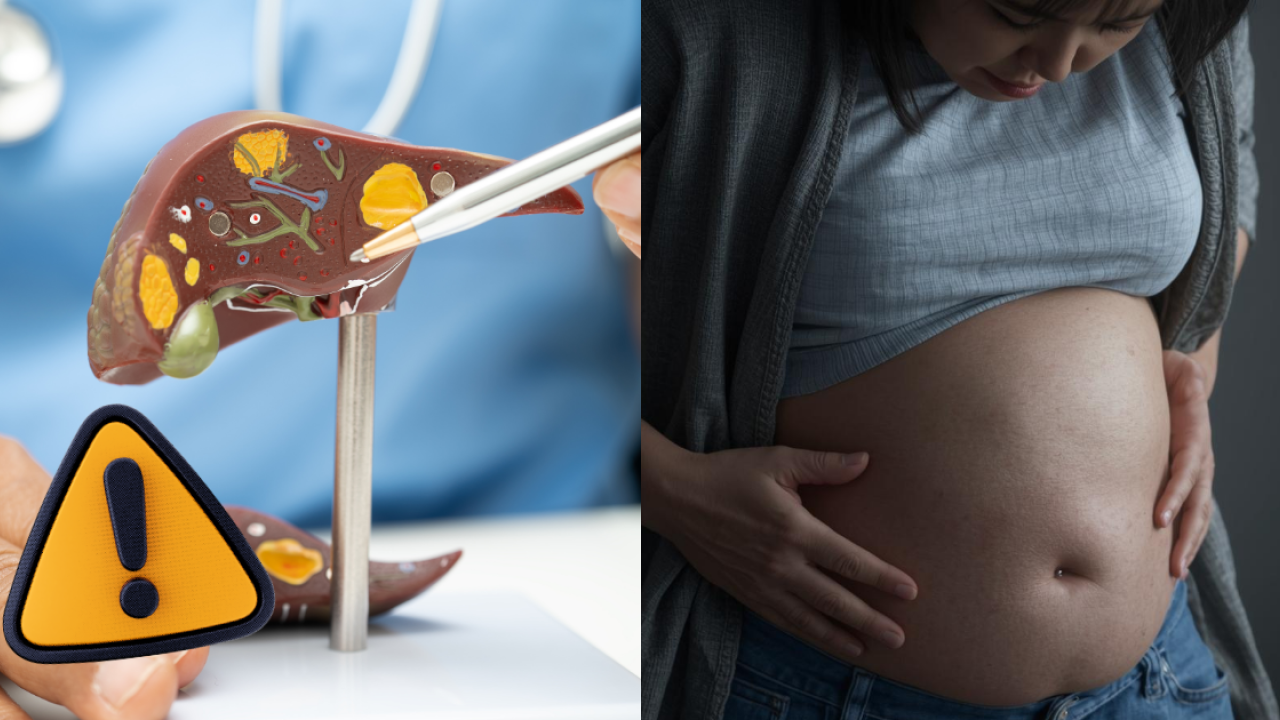 肚腩大以為肥？60歲婦拍肚皮呈1種聲確診肝癌末期！醫生：聽到呢種聲要小心