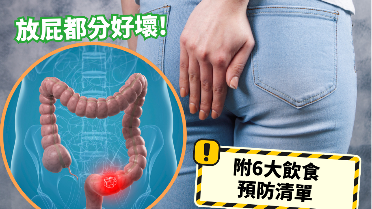 經常放連環屁恐是大腸癌先兆？醫生揭腫瘤塞腸恐怖真相：長時間無屁放更危險！
