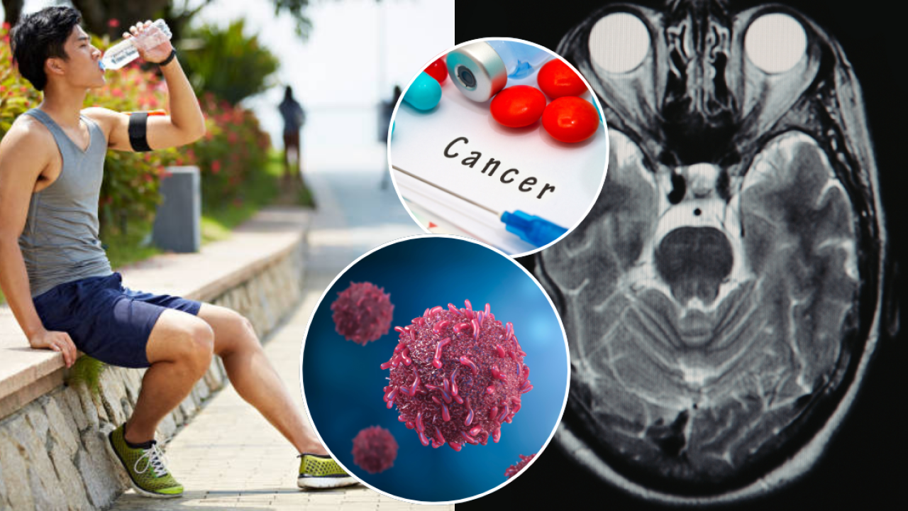 16歲仔每日狂飲9公升水 竟揭患腦癌！醫生揭恐怖真相：水中毒致腦腫脹／4大症狀即求醫