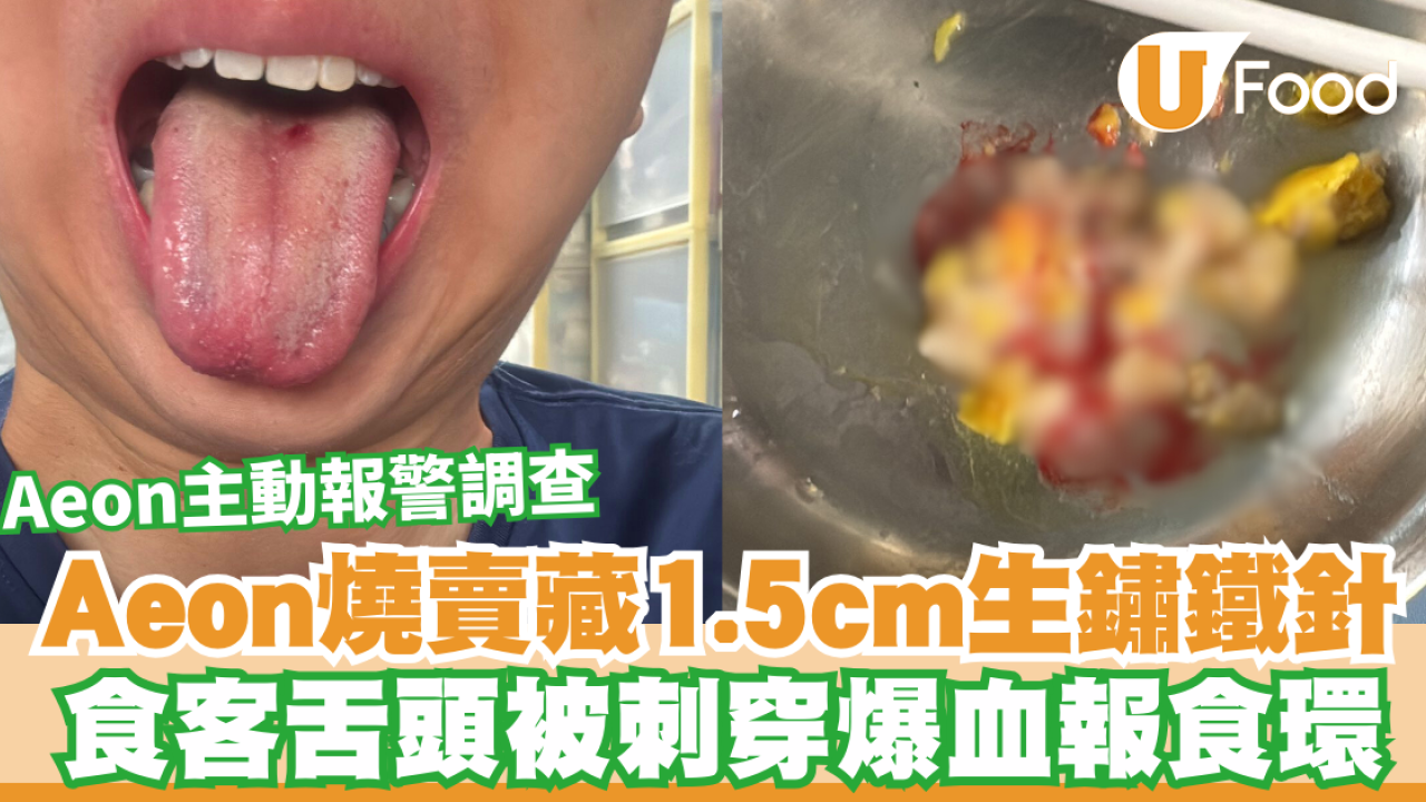 屯門Aeon燒賣藏1.5cm生鏽鐵針  食客舌頭被刺穿爆血報食環／Aeon主動報警調查