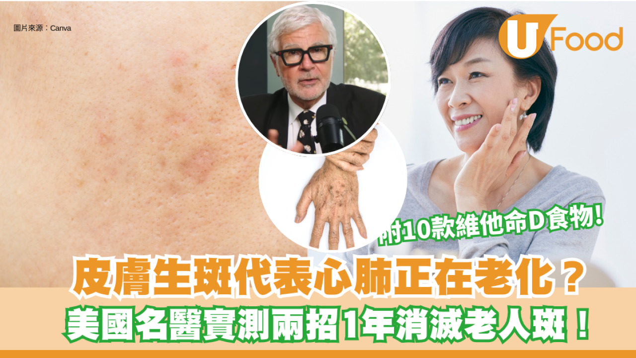 老人斑｜皮膚生斑代表心肺正在老化？美國名醫靠「這兩招」1年消滅老人斑！附10款維他命D食物有效延緩衰老3年