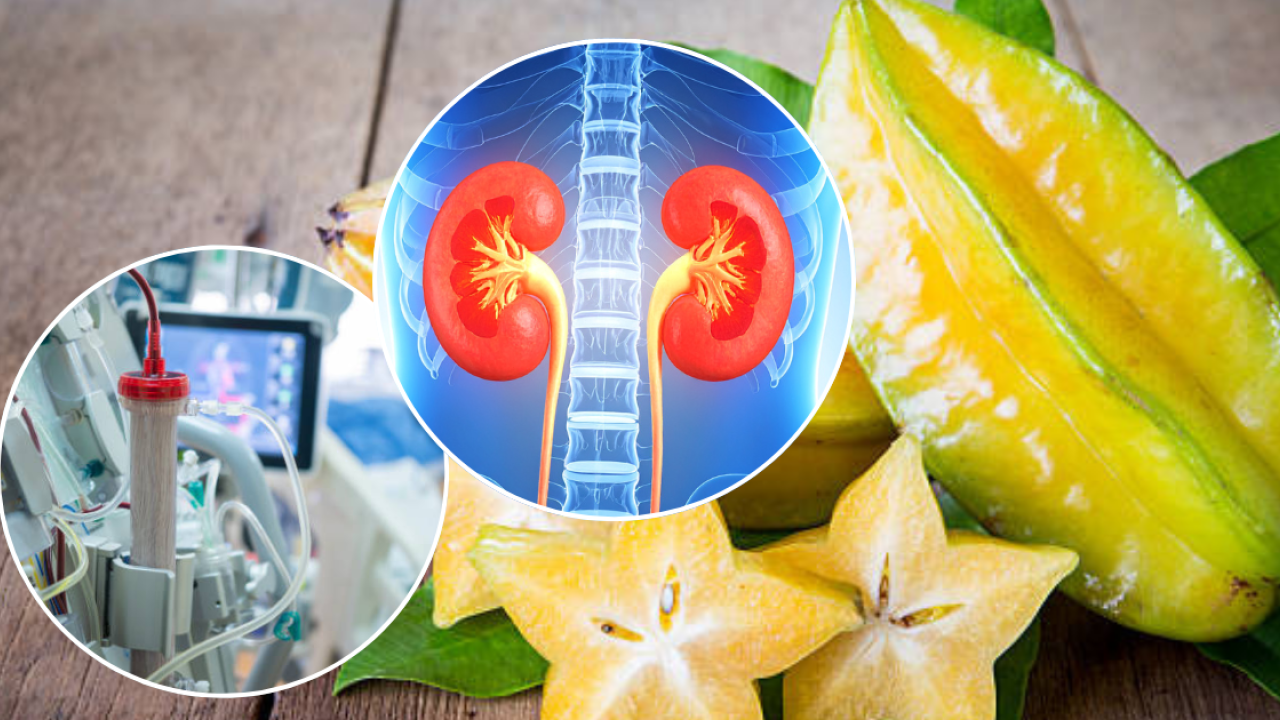 醫生警告楊桃可重創腎臟：健康人士食4顆恐引急性腎衰竭／4類人食分分鐘喪命