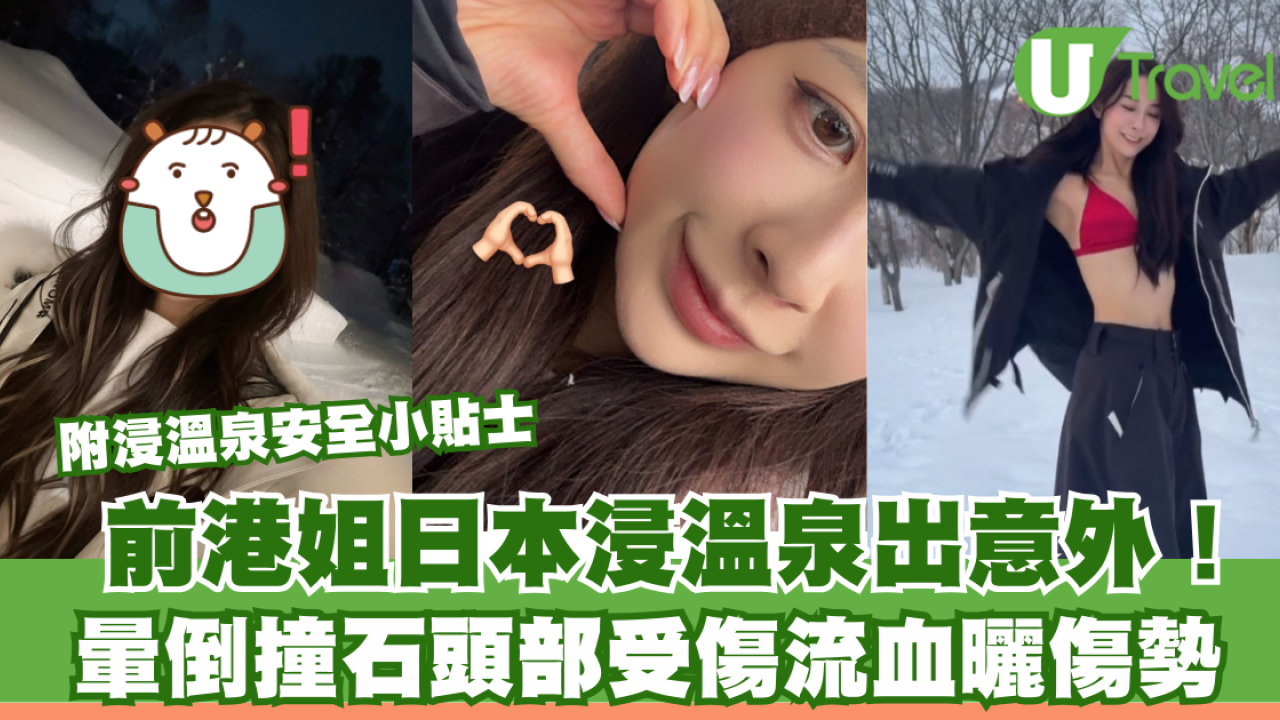 前港姐黃婉恩日本出意外！浸溫泉暈倒撞石頭破血流 附浸溫泉安全小貼士