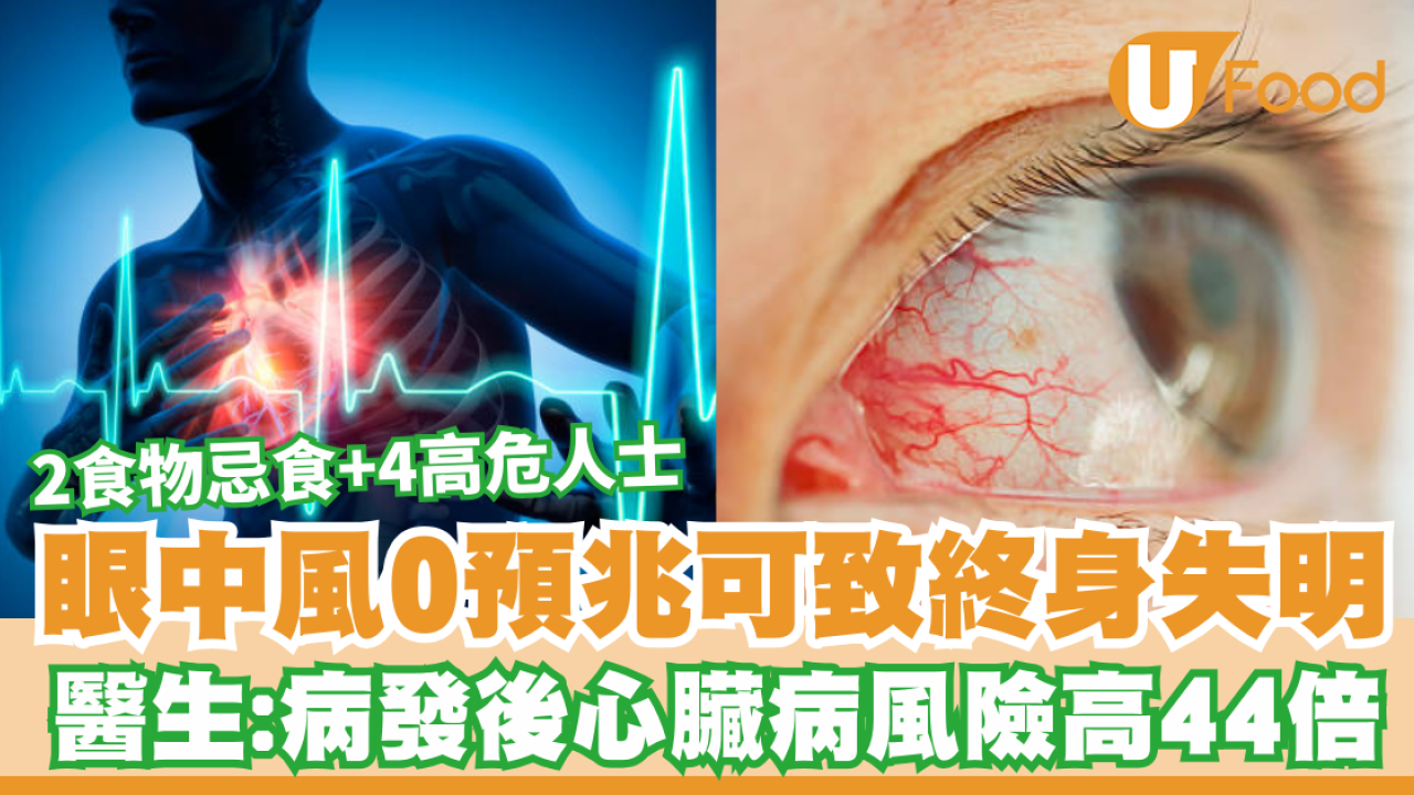 眼中風症狀｜視力模糊恐是視網膜動脈閉塞！醫生揭0痛感致盲 病發心臟病風險高44倍 附4大高危人士/護眼食物