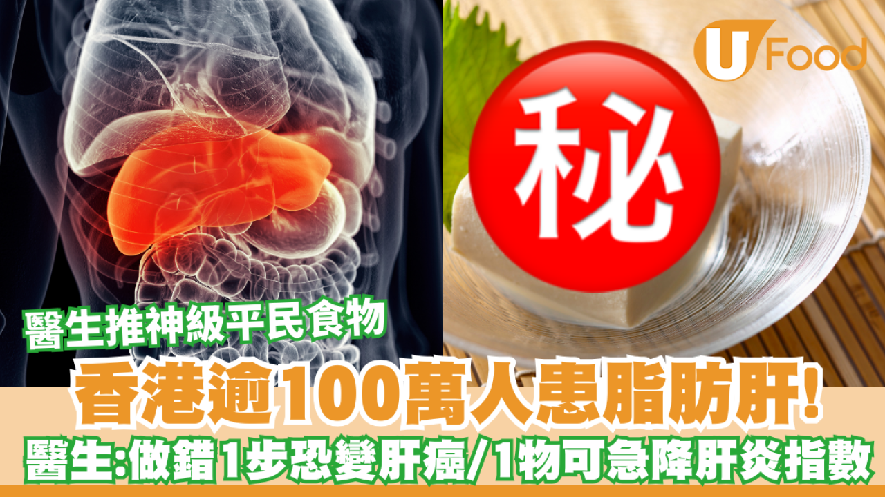 香港逾百萬人患脂肪肝！醫生警告做錯1步恐變肝癌  每日食1款平民食物12週極速降肝炎指數