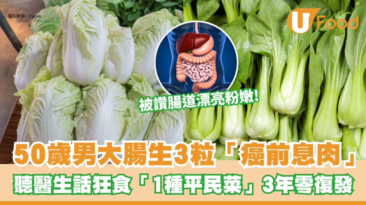 大腸癌︱50歲男大腸生3粒「癌前息肉」！聽醫生話狂食「1種平民菜」 3年後腸道粉嫩零復發