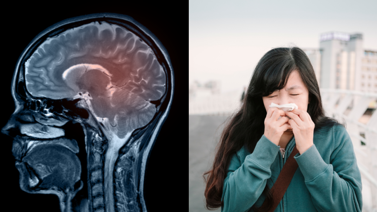 以為普通鼻敏感？醫生警告1種清水鼻涕極危險！隨時是腦液流出3類人最高危