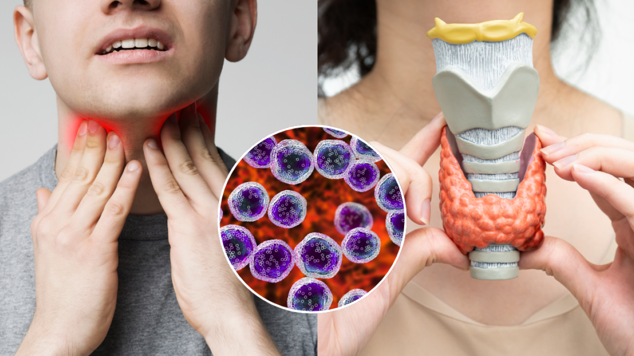 淋巴癌初期症狀｜70歲男3個月生14cm巨瘤！醫生揭6大發病先兆 咳/出汗/發燒要小心