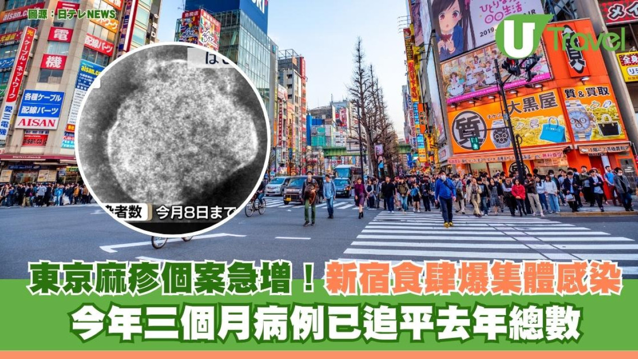 東京麻疹個案急增！ 新宿食肆爆集體感染 今年病例已追平去年總數