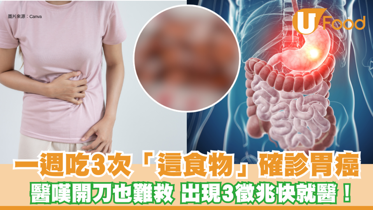 胃癌｜40歲女一週吃3次「這食物」確診胃癌 醫嘆開刀也難救 出現3徵兆快就醫！