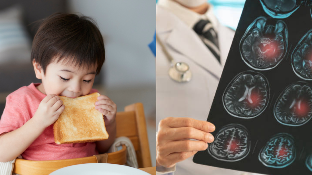 專家揭不吃早餐5大癌症風險增近6倍！醫生：或致缺血性腦中風／女子因此生60粒膽石...