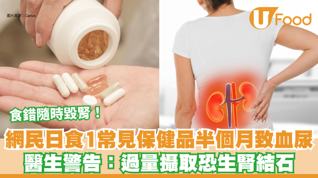 保健品｜網民日食1常見保健品半個月致血尿 醫生警告：過量攝取恐生腎結石 