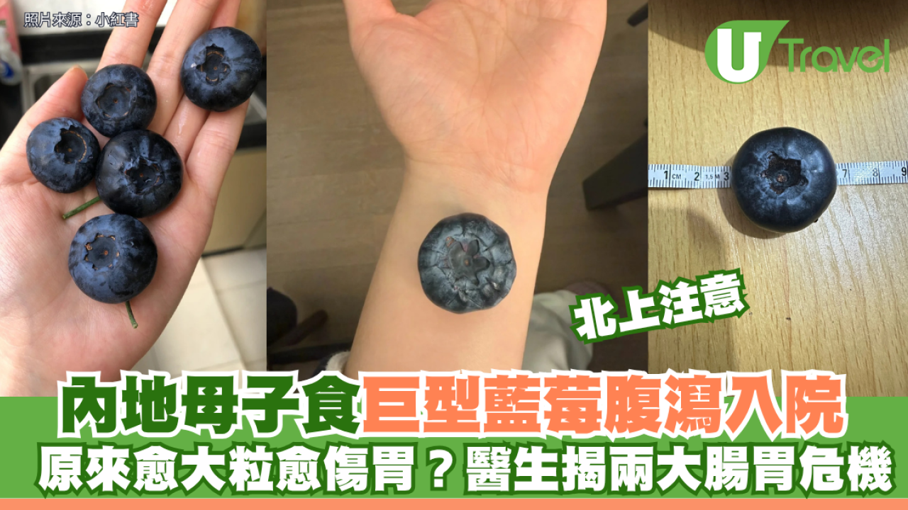 內地母子食巨型藍莓腹瀉入院 原來愈大粒愈傷胃？醫生揭兩大腸胃危機