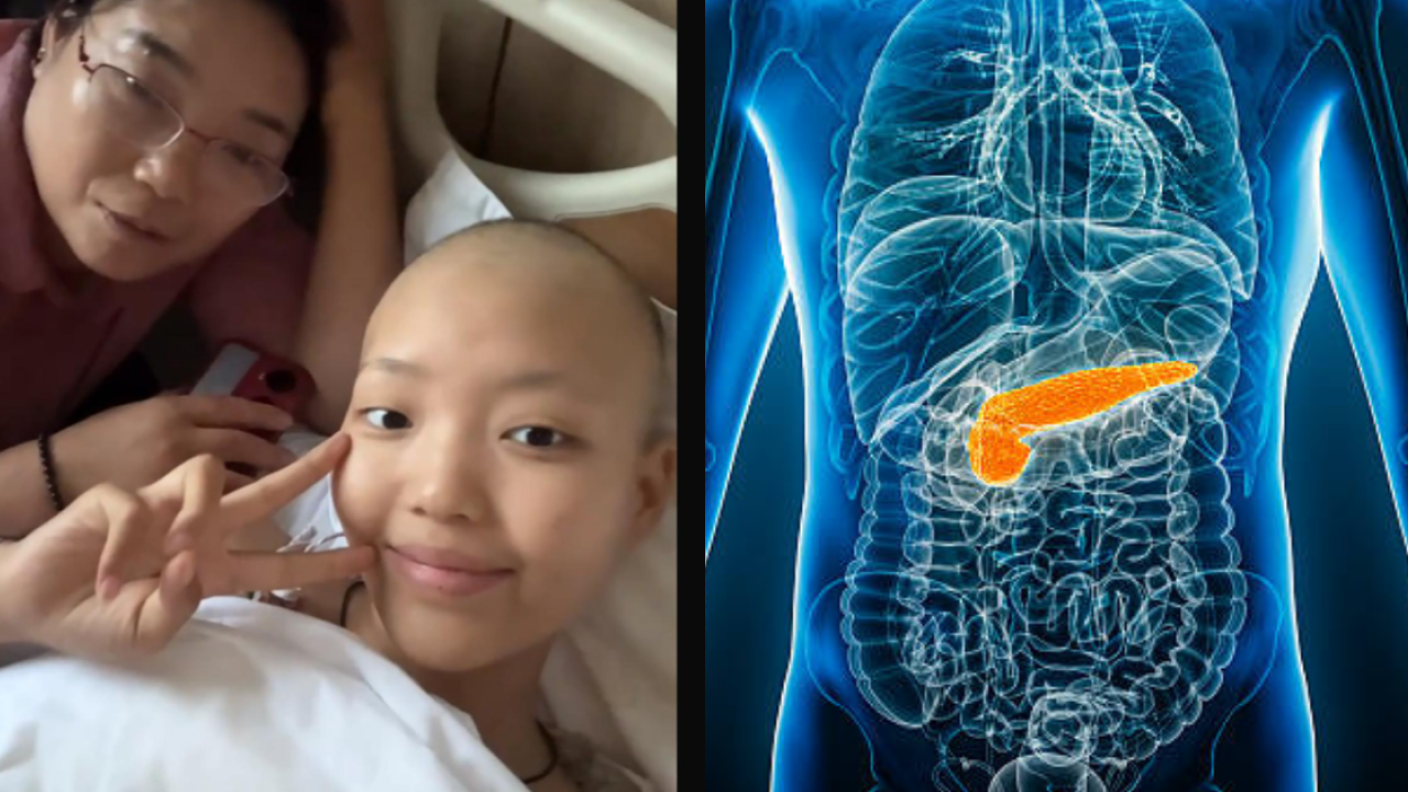 19歲女學霸為慳錢節食患胰臟癌晚期！暴瘦胃痛被誤診 經歷12次化療全家傾家蕩產救女