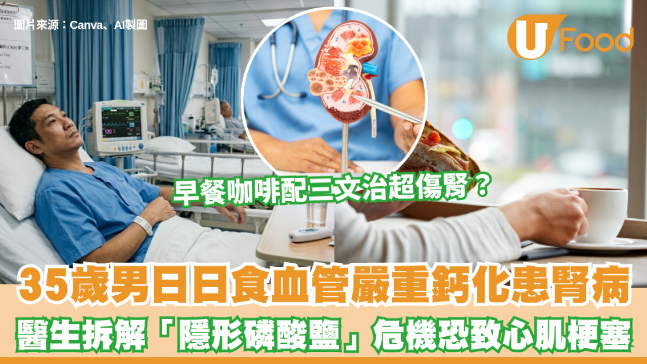 早餐咖啡配三文治超傷腎？35歲男日日食血管嚴重鈣化患腎病 醫生拆解「隱形磷酸鹽」危機 吸收率達100%恐致心肌梗塞