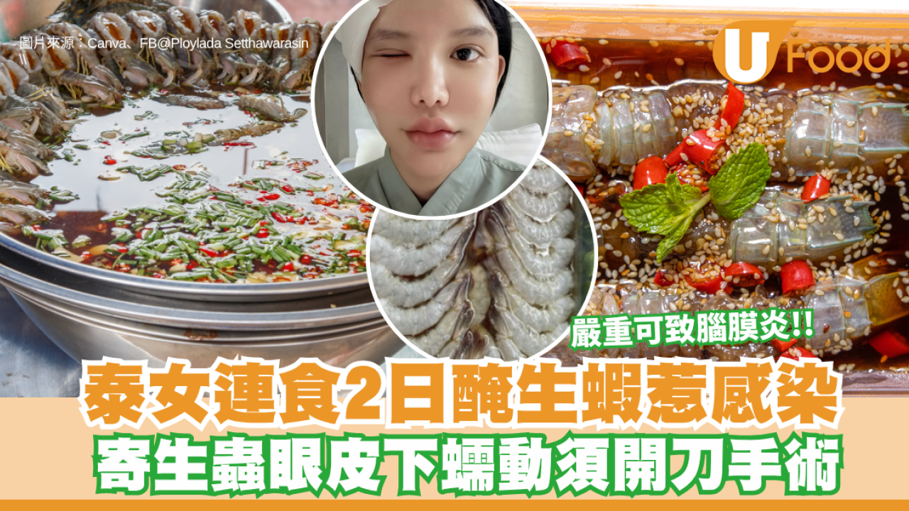 生醃海鮮｜泰女連食2日醃生蝦惹感染 寄生蟲眼皮下蠕動須開刀手術！醫生警告:嚴重可致腦膜炎