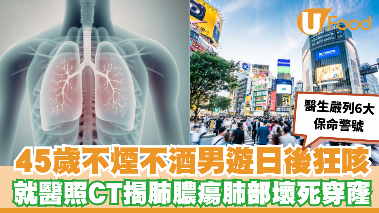 45歲不煙不酒男遊日後狂咳 照CT揭肺部壞死穿窿！醫生拆解肺膿瘍危機 附6大保命警號