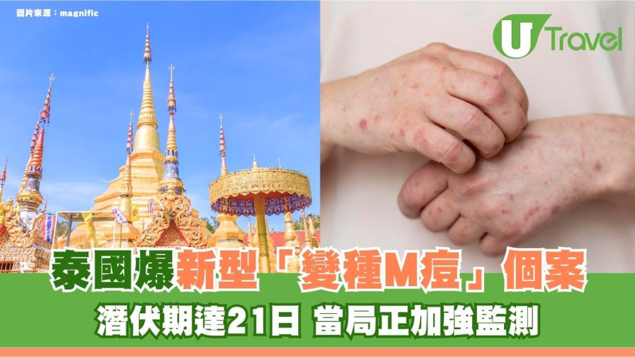 遊泰注意｜泰國爆新型「變種M痘」個案！潛伏期達21日 當局正加強監測