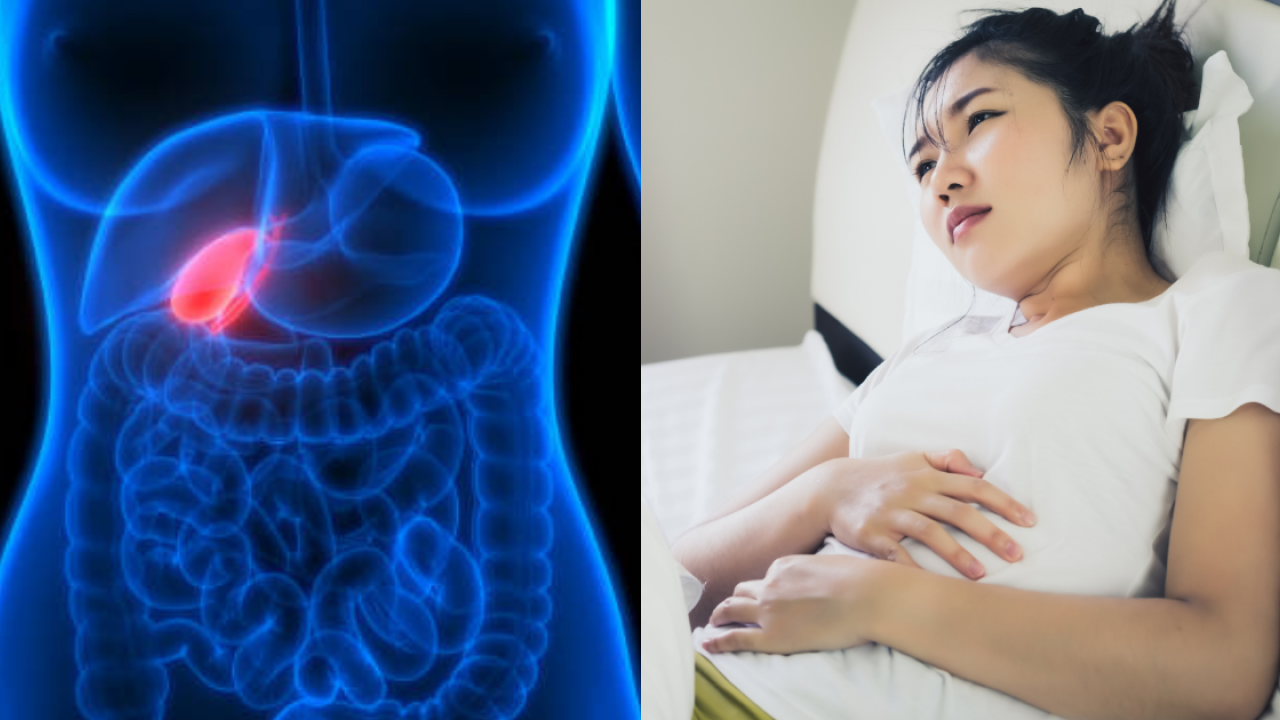 27歲女長期胃痛竟是患膽結石！醫生點名3大高危習慣：已有年輕化趨勢