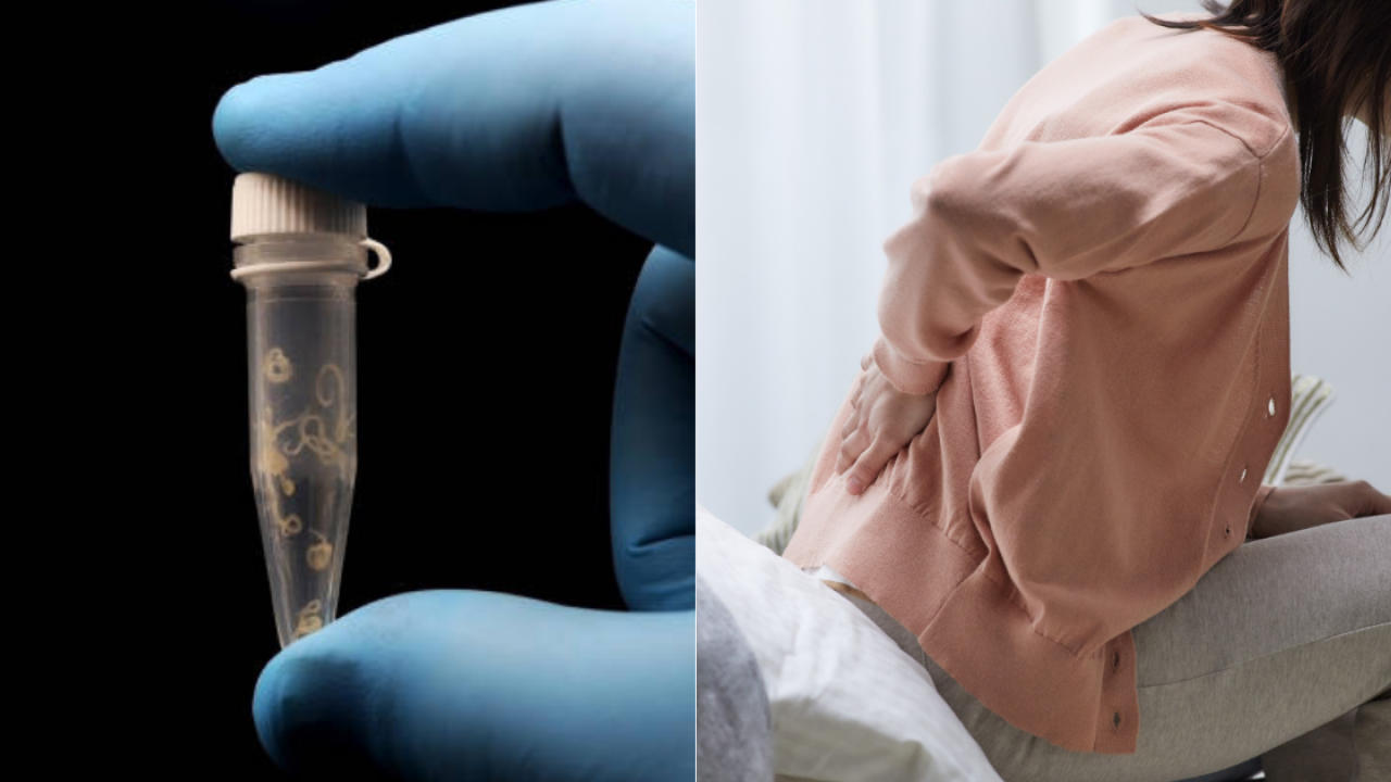 以為普通腰痛？57歲婦險癱瘓 開刀驚揭逾千條寄生蟲藏脊髓！醫生警告2大惡習