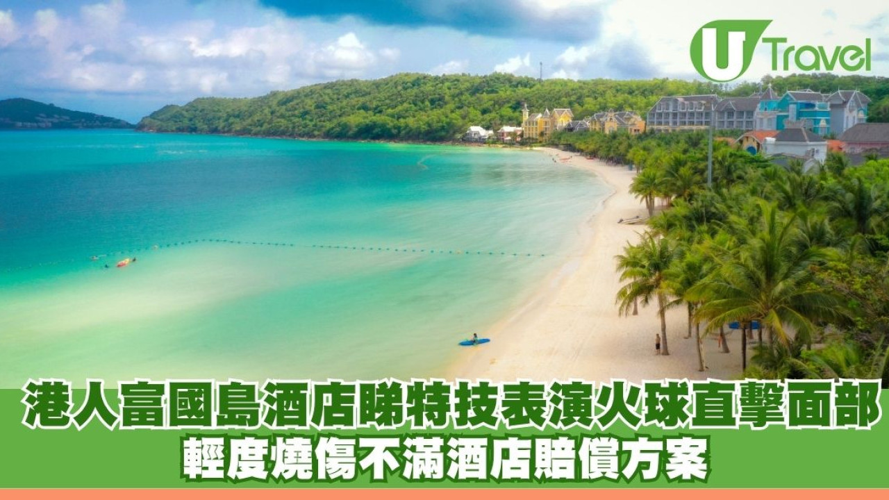 港人富國島酒店睇特技表演火球直擊面部 輕度燒傷不滿酒店賠償方案