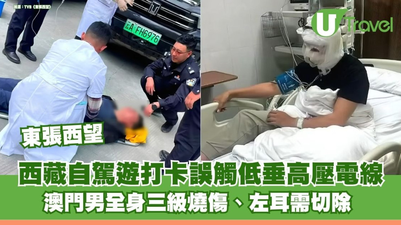 東張西望｜西藏自駕遊打卡誤觸低垂高壓電線 澳門男全身三級燒傷、左耳需切除 家屬索償700萬