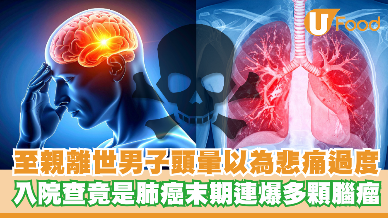 至親離世突發頭暈不止！男子以為悲痛過度  入院查竟是肺癌末期連爆多顆腦瘤
