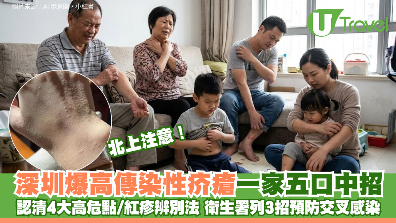 北上注意！深圳爆高傳染性疥瘡一家五口中招 認清4大高危點/紅疹辨別法 衛生署列3招預防交叉感染