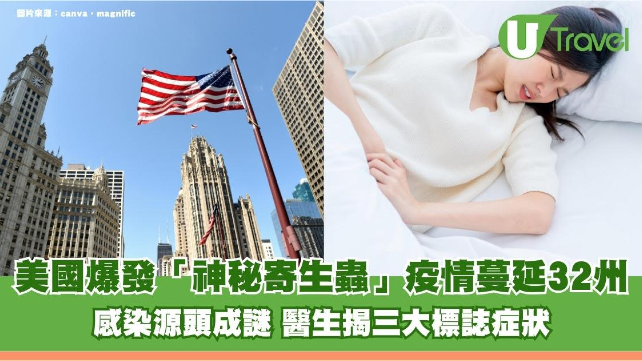 美國爆發「神秘寄生蟲」疫情蔓延32州！感染源頭成謎 醫生揭三大標誌症狀