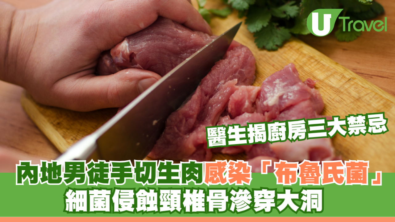內地男徒手切生肉染「布魯氏菌」細菌侵蝕頸椎骨滲穿大洞 醫生揭廚房三大禁忌