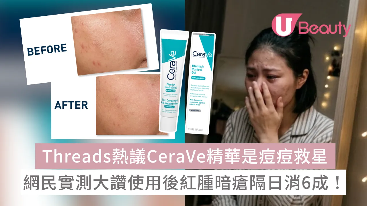 Threads熱議CeraVe精華是痘痘救星！網民實測大讚使用後紅腫暗瘡隔日消6成！