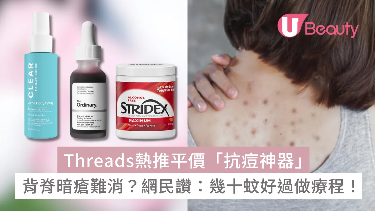 Threads熱推平價「抗痘神器」：背脊暗瘡難消？網民讚：幾十蚊好過做療程！