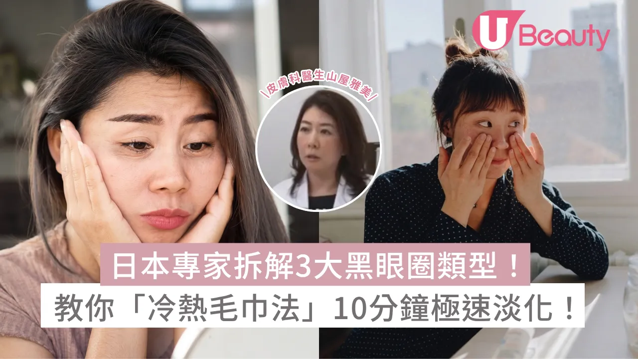 日本專家拆解3大黑眼圈類型！教你「冷熱毛巾法」10分鐘極速淡化！