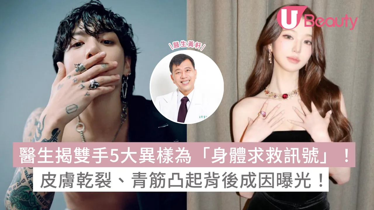 醫生揭雙手5大異樣為「身體求救訊號」！皮膚乾裂、青筋凸起背後成因曝光！ 