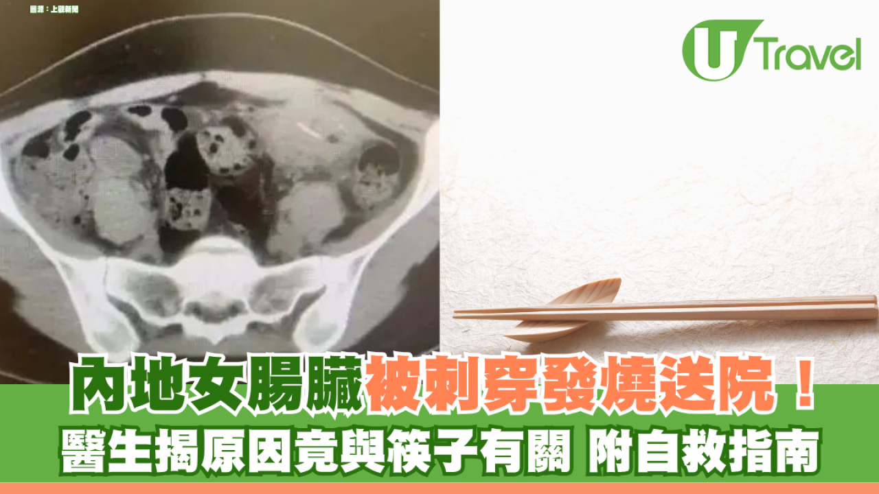 邊食飯邊睇手機險死！內地女腸臟被刺穿發燒送院！醫生揭原因竟與筷子有關 附自救指南