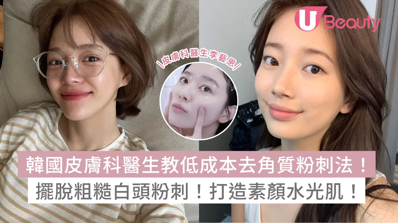 韓國皮膚科醫生教低成本去角質粉刺法！擺脫粗糙白頭粉刺！重拾素顏水光肌！