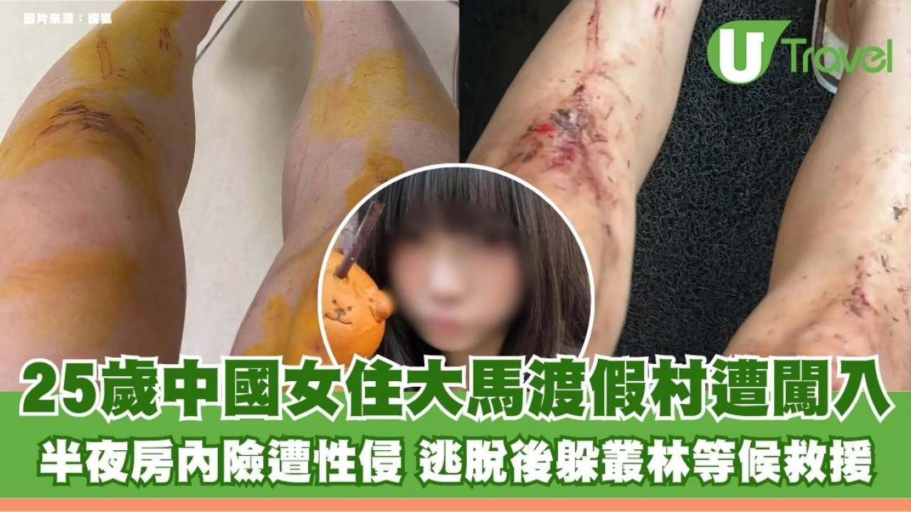25歲中國女住大馬渡假村遭闖入！半夜房內險遭性侵 逃脫後躲叢林等候救援