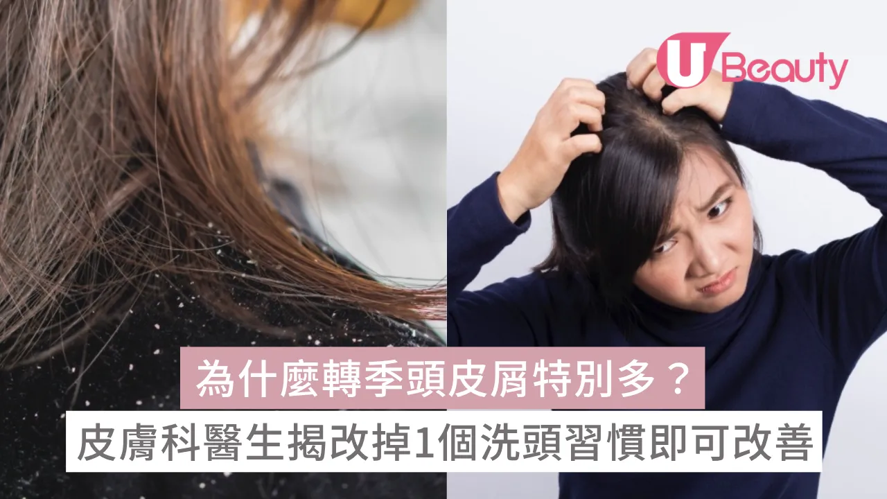 為什麼轉季頭皮屑特別多？皮膚科醫生揭改掉1個洗頭習慣即令頭皮恢復平衡