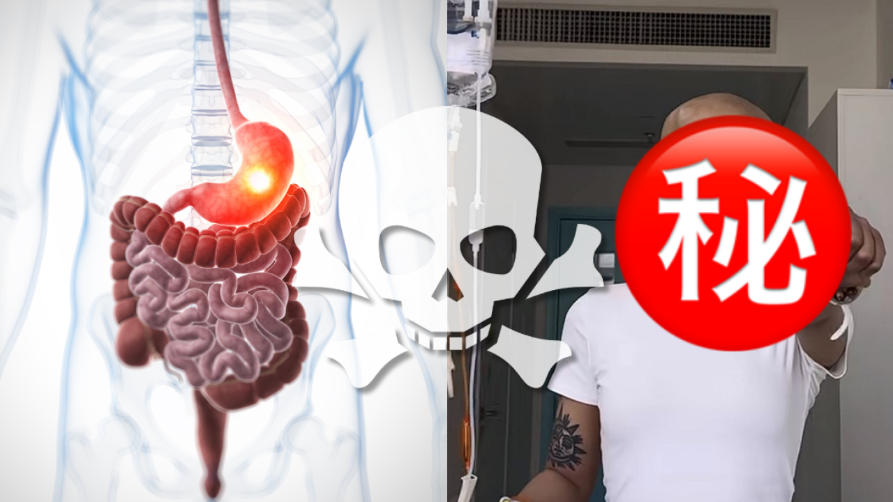 25歲KOL胃癌離世  生前愛咖啡汽水常熬夜／醫生警告6類高危人士需定期胃鏡檢查